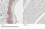 Nectin 4 Antibody in Immunohistochemistry (Paraffin) (IHC (P))
