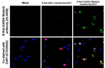 B-Raf (G469A Mutant) Antibody in Immunohistochemistry (Paraffin) (IHC (P))