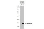 TAS2R38 Recombinant Rabbit Monoclonal Antibody (HL4024)