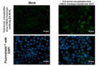 Tick-Borne Encephalitis Virus Envelope Recombinant Rabbit Monoclonal Antibody (HL4031)