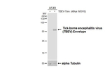 Tick-Borne Encephalitis Virus Envelope Antibody in Western Blot (WB)