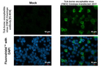 Tick-Borne Encephalitis Virus Envelope Recombinant Rabbit Monoclonal Antibody (HL4034)