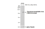 Tick-Borne Encephalitis Virus Envelope Antibody in Western Blot (WB)