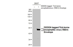 Tick-Borne Encephalitis Virus Envelope Antibody in Western Blot (WB)