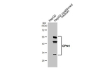 CPN1 Recombinant Rabbit Monoclonal Antibody (HL4040)