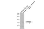 GPRC5D Antibody in Western Blot (WB)