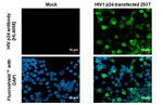 HIV1/2 p24 Recombinant Rabbit Monoclonal Antibody (HL4058)