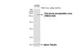 Tick-Borne Encephalitis Virus NS5 Antibody in Western Blot (WB)