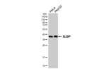 SLBP Recombinant Rabbit Monoclonal Antibody (HL4075)