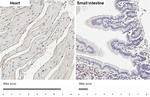LPHN2 Recombinant Rabbit Monoclonal Antibody (HL4090)