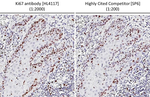 Ki-67 Antibody in Immunohistochemistry (Paraffin) (IHC (P))