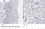 Ki-67 Antibody in Immunohistochemistry (Paraffin) (IHC (P))