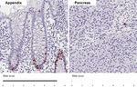 Ki-67 Antibody in Immunohistochemistry (Paraffin) (IHC (P))