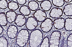 Ki-67 Antibody in Immunohistochemistry (Paraffin) (IHC (P))