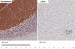 mGluR1 Antibody in Immunohistochemistry (Paraffin) (IHC (P))