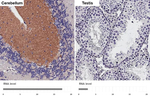 mGluR1 Antibody in Immunohistochemistry (Paraffin) (IHC (P))