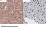 mGluR1 Antibody in Immunohistochemistry (Paraffin) (IHC (P))