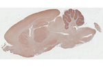 mGluR1 Antibody in Immunohistochemistry (Paraffin) (IHC (P))