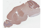 mGluR1 Antibody in Immunohistochemistry (Paraffin) (IHC (P))