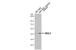 NEIL2 Antibody in Western Blot (WB)