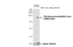 Tick-Borne Encephalitis Virus NS3 Recombinant Rabbit Monoclonal Antibody (HL4154)