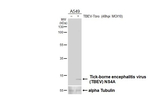 Tick-Borne Encephalitis Virus NS4A Antibody in Western Blot (WB)