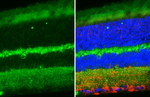 BAI1 Antibody in Immunohistochemistry (Paraffin) (IHC (P))