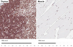 YY1 Antibody in Immunohistochemistry (Paraffin) (IHC (P))