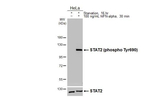 Phospho-STAT2 (Tyr690) Antibody in Western Blot (WB)