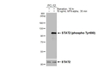 Phospho-STAT2 (Tyr690) Recombinant Rabbit Monoclonal Antibody (HL4208)