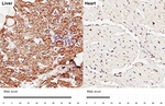 SLC25A1 Antibody in Immunohistochemistry (Paraffin) (IHC (P))