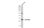 SLC25A1 Antibody in Western Blot (WB)