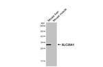 SLC25A1 Antibody in Western Blot (WB)