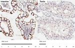 SLC25A1 Antibody in Immunohistochemistry (Paraffin) (IHC (P))