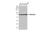 NFkB p65 Antibody in Western Blot (WB)