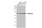 NFkB p65 Antibody in Western Blot (WB)
