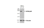 NFkB p65 Antibody in Western Blot (WB)
