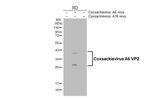 Coxsackievirus A6 VP2 Antibody in Western Blot (WB)