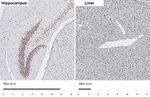 LSD1 Antibody in Immunohistochemistry (Paraffin) (IHC (P))