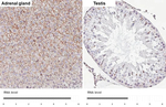 Flotillin 1 Antibody in Immunohistochemistry (Paraffin) (IHC (P))
