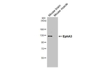 EphA3 Recombinant Rabbit Monoclonal Antibody (HL4264)