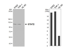 STAT2 Recombinant Rabbit Monoclonal Antibody (HL4277)