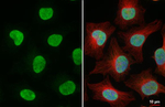 ESRRA Antibody in Immunocytochemistry (ICC/IF)