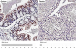 ESRRA Antibody in Immunohistochemistry (Paraffin) (IHC (P))