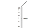 PADI4 Antibody in Western Blot (WB)