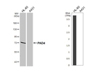 PADI4 Recombinant Rabbit Monoclonal Antibody (HL4309)
