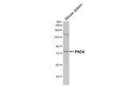 PADI4 Antibody in Western Blot (WB)