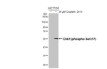 Phospho-Chk1 (Ser317) Antibody in Western Blot (WB)