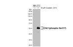 Phospho-Chk1 (Ser317) Antibody in Western Blot (WB)