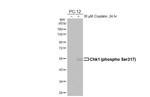 Phospho-Chk1 (Ser317) Antibody in Western Blot (WB)